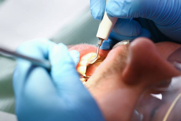 Best Emergency Dental Care for Broken or Chipped Teeth in Big Bend, WI