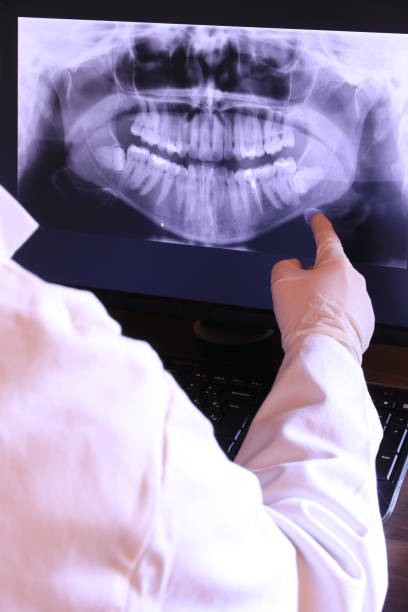 Best Emergency Root Canal Treatment in Big Bend, WI
