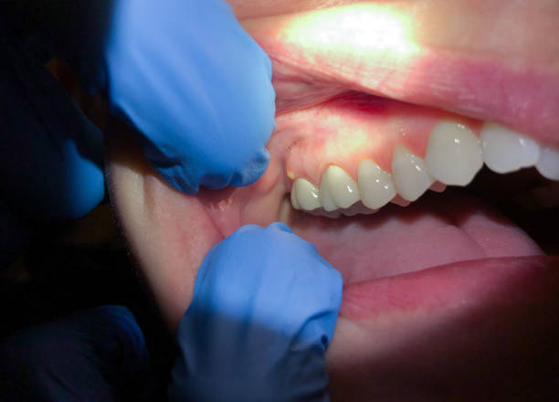 Best Cosmetic Emergency Dentistry in Big Bend, WI