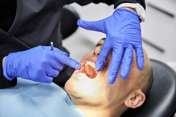 Best Urgent Care for Lost Fillings or Crowns in Big Bend, WI
